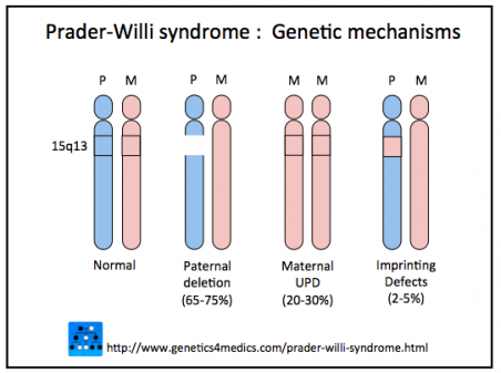 Schematic depiction of the chromosomal basis of Prader-Willi Syndrome