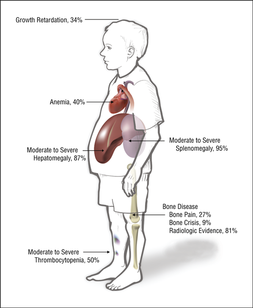 Prevalence of affected organ involvement in Gaucher disease