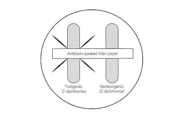 Elek immunodiffusion test: Sterile filter paper impregnated with diphtheria antitoxin is imbedded in agar culture medium. Isolates of C diphtheriae are then streaked across the plate at an angle of 90° to the antitoxin strip. Toxigenic C diphtheriae is detected because secreted toxin diffuses from the area of growth and reacts with antitoxin to form lines of precipitin.