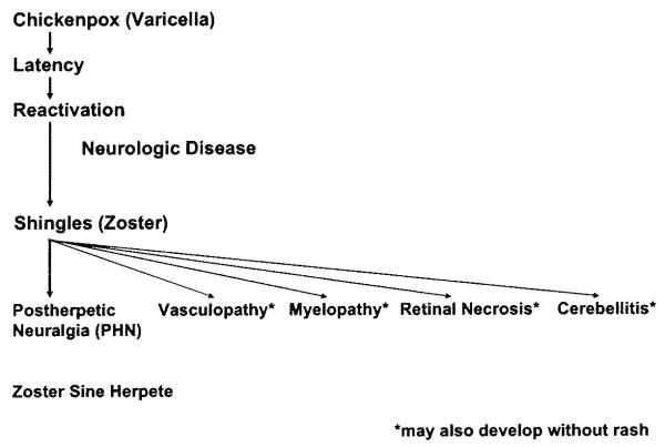 Neurologic complications of varicella zoster virus reactivation