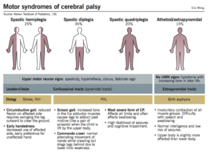 Clinical types of CP
