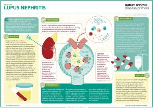 Lupus nephritis