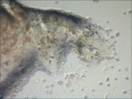 Culture of Acanthamoeba on nonnutrient agar with an overlay of Escherichia coli.