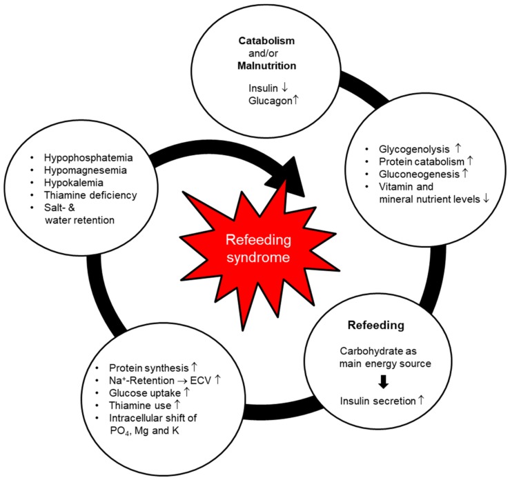 Pathophysiology of refeeding syndrome