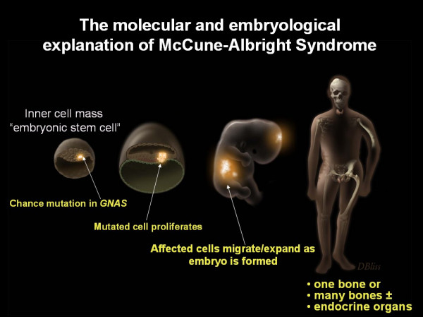 Molecular and developmental defect in McCune-Albright syndrome (MAS)