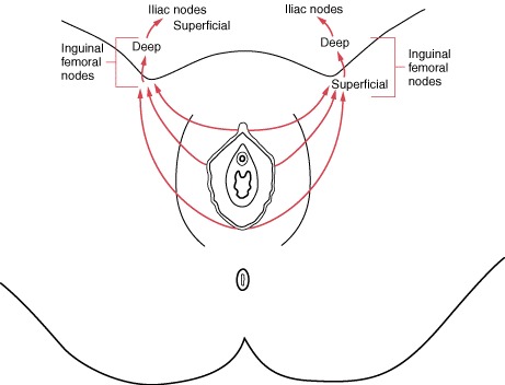 Lymphatic drainage of the vulva
