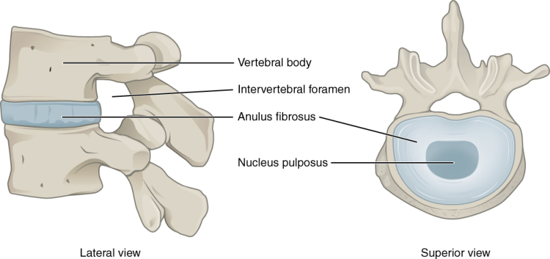 Intervertebral disc